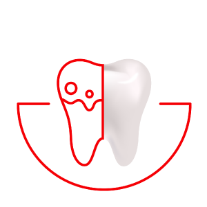 Prevence zubního kamene