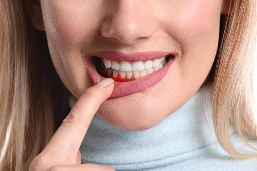 žena ukazuje její žvýkačku